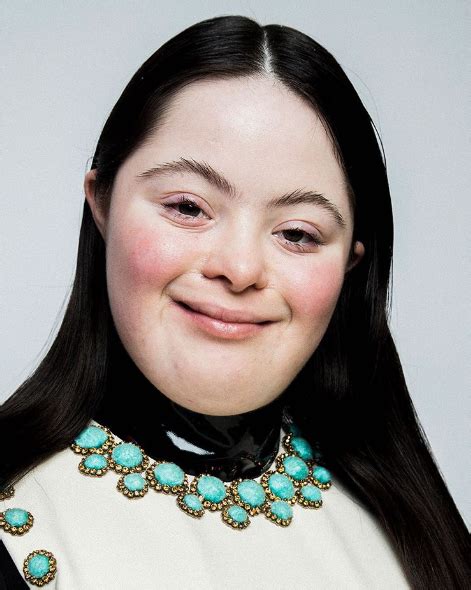 modella down gucci|gucci down syndrome.